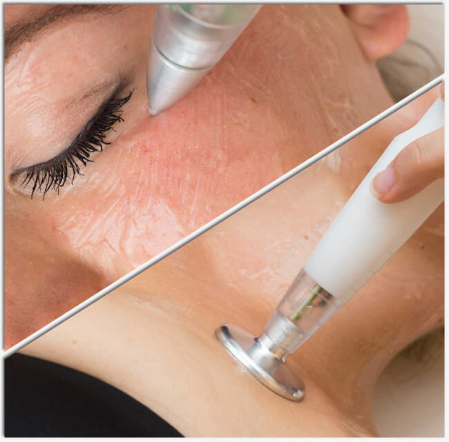 Θεραπείες Plasma Lift Jett