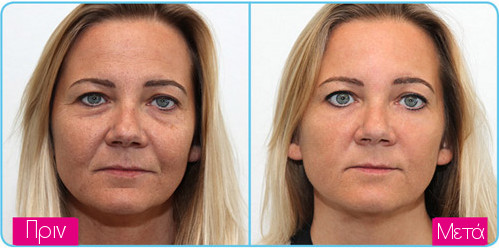 Dermatude face1 ba