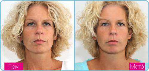 Dermatude face2 ba